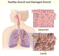 COPD disability claim