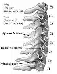 neck cervical disability claim