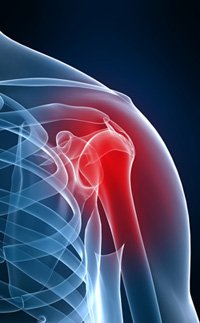 shoulder disorder disability benefits claim