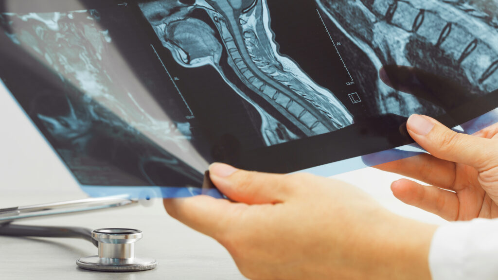 It is helpful to have MRI's of neck and back for software developer conditions MRI's of neck and back for software developer conditions